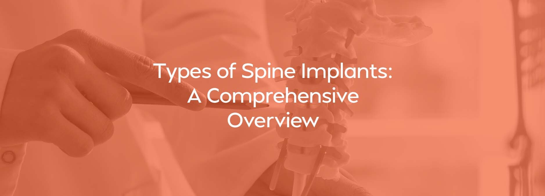 Types of Spine Implants: A Comprehensive Overview